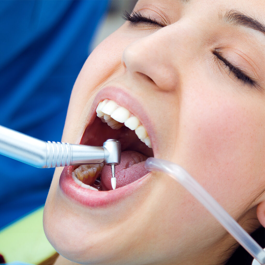 Best Dental Treatment In Kolkata