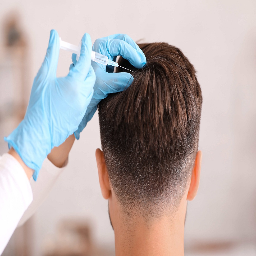 Hair Loss Treatment