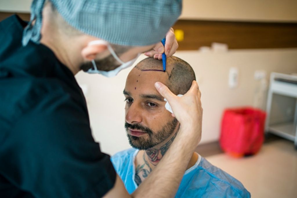 Best hair transplant clinic in kolkata