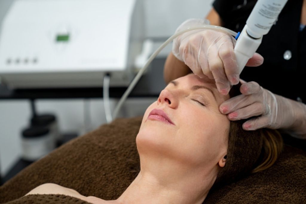 laser treatment for wrinkles