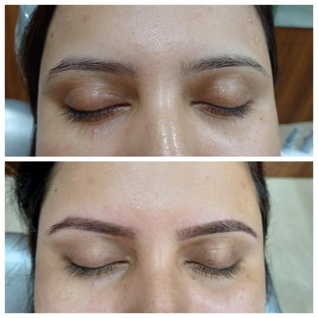 Best Skin Treatment in Kolkata