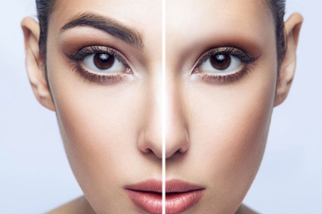 Causes of eyebrow hair loss