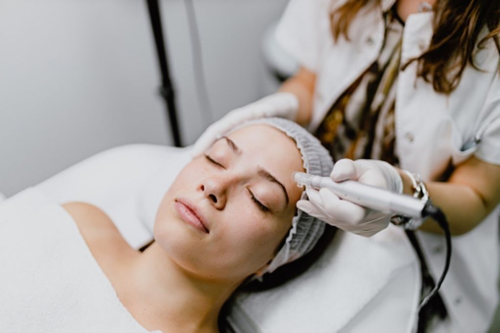 micro needling treatment