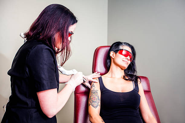 Tattoo Removal Treatment